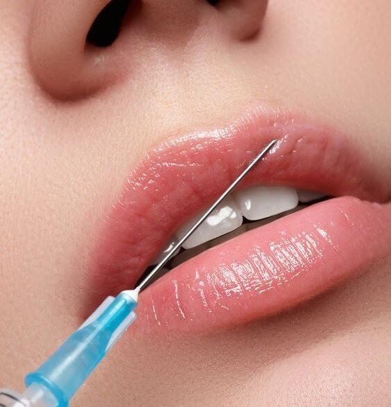 Aumento de labios