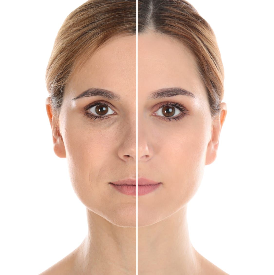 Limpieza facial farmacéutica